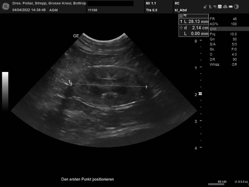 Ultraschallbild Niere Katze
